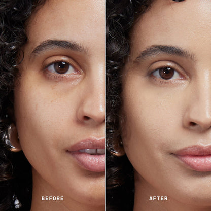 Skin Solution