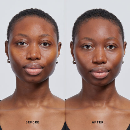 Skin Solution