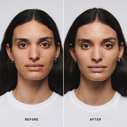 Skin Solution